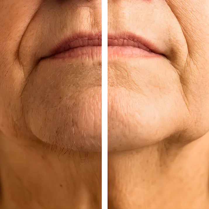 Bellaluny™ 2-in-1 Painless Facial Hair Remover