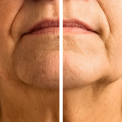 Bellaluny™ 2-in-1 Painless Facial Hair Remover