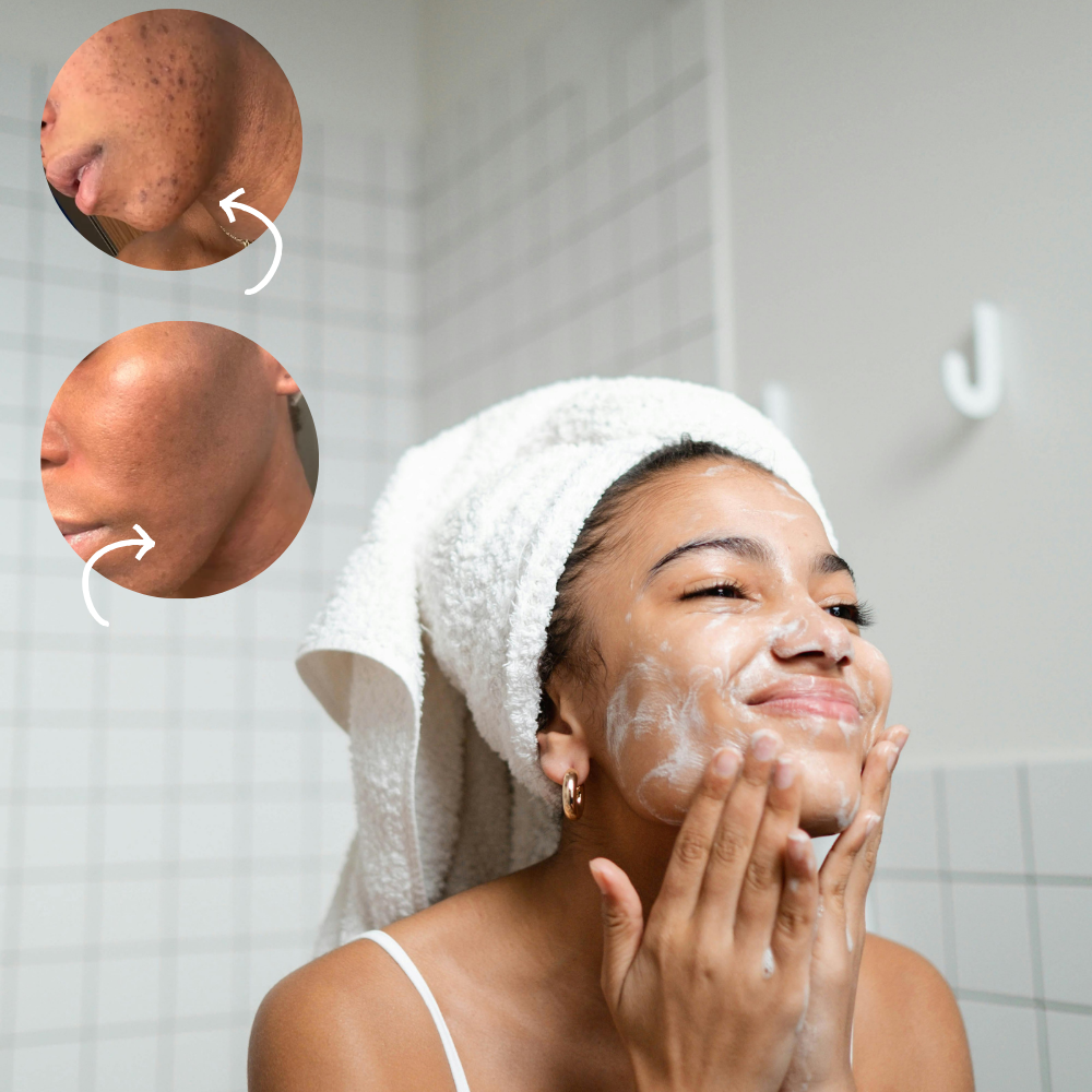 😍50% KORTING - BIOLOGISCHE Citroen Kurkuma en Kojinezuur Huidverhelderende Zeep (🔥MOEDERDAG🔥) 