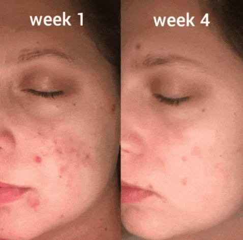 🔥VORIGE WEEK, MOEDERDAG✨ DLY™ Wateroplosbare collageenfilmpleister 