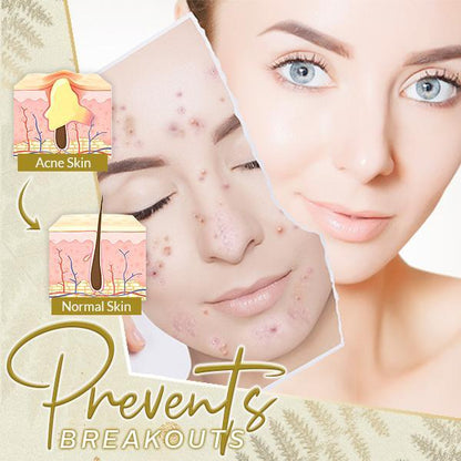 Suero con oro de 24 quilates Line Rewind de ActiveSkin™ 