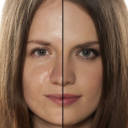 Olie-absorberende vulkanische gezichtsroller